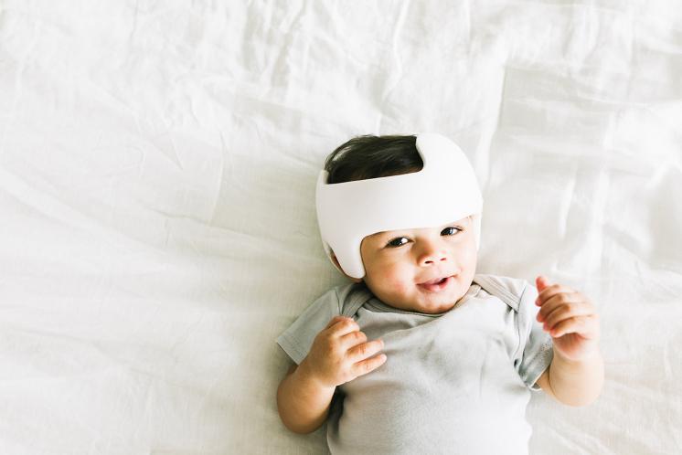 9 month old baby boy wearing a doc band helmet laying down looking at camera
