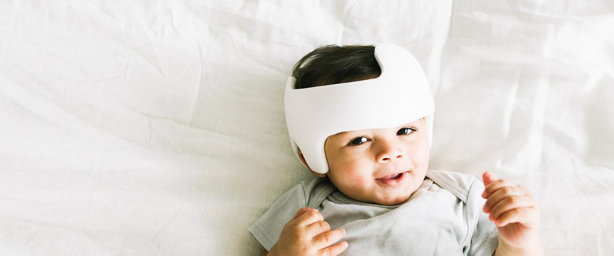 9 month old baby boy wearing a doc band helmet laying down looking at camera